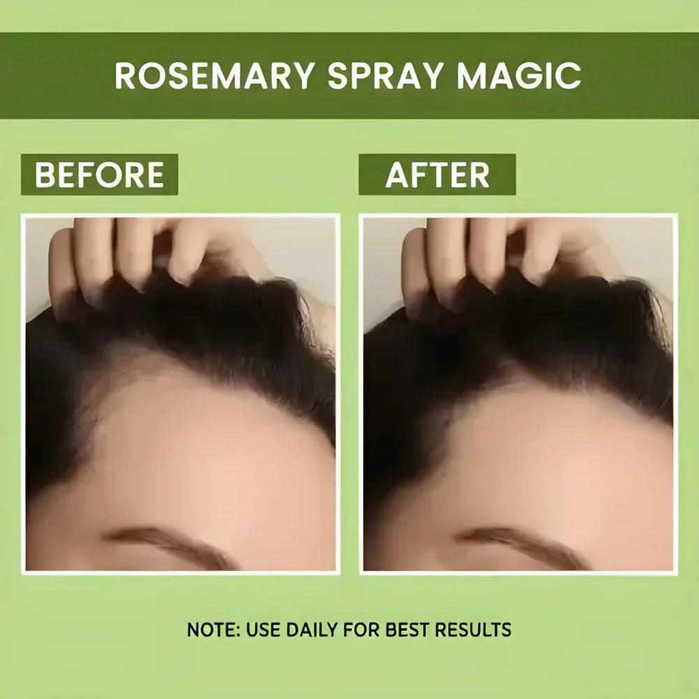 Rosemary Water Spray | For Hair Regrowth (Buy 1 Get 2 Free 😍) - Yesh Mart