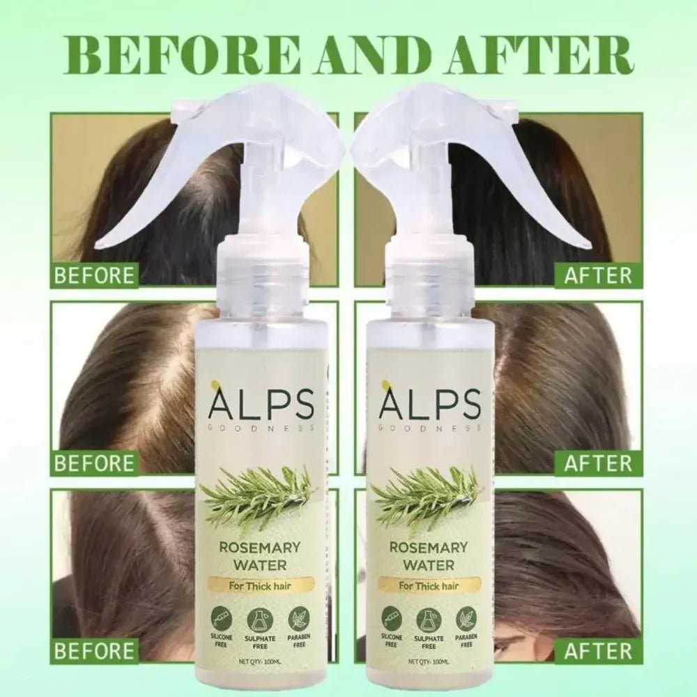 Rosemary Water Spray | For Hair Regrowth (Buy 1 Get 2 Free 😍) - Yesh Mart