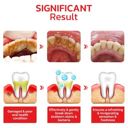 SP4 Ultra Whitening Probiotic Toothpaste - Yesh Mart